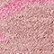 Medium Pink