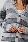 BDG Eliot Striped Oversized Cardigan